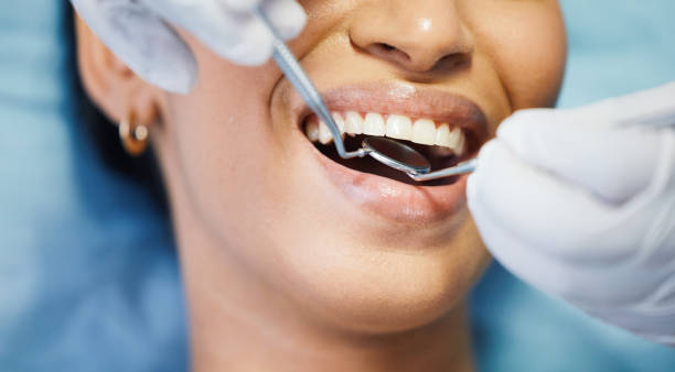 Best Emergency Cosmetic Dentistry in Davis, CA
